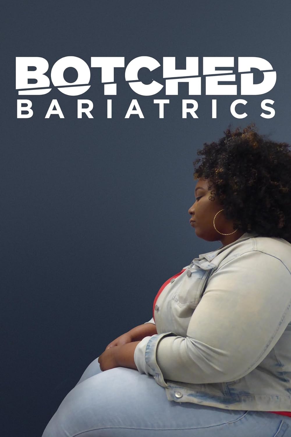 Botched Botched