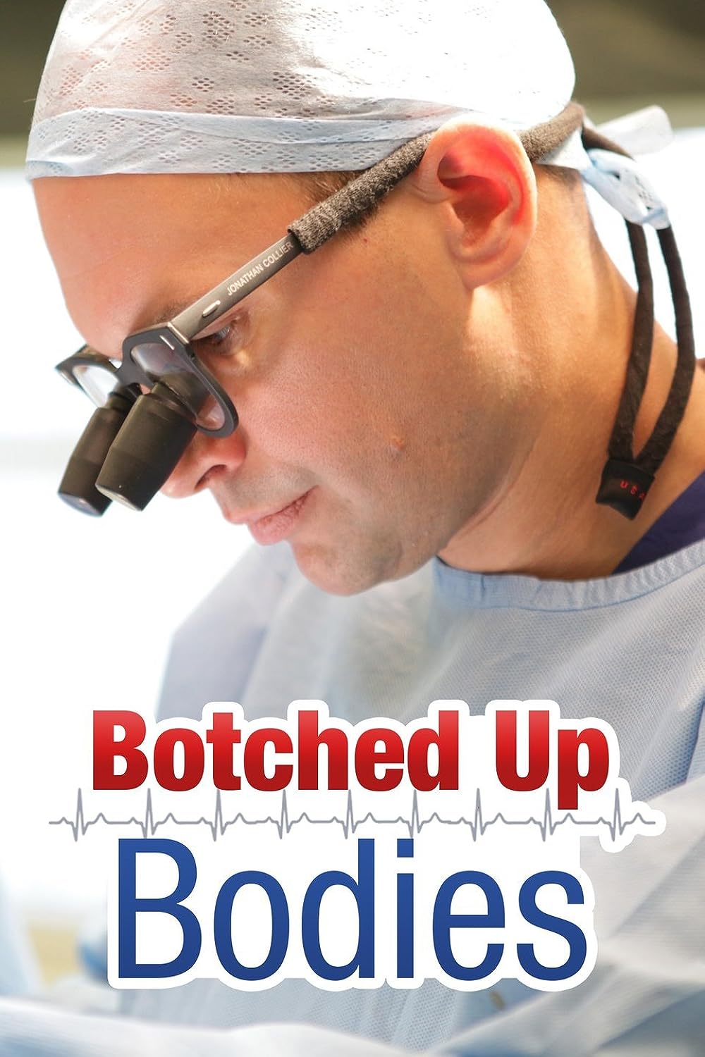 Botched Botched