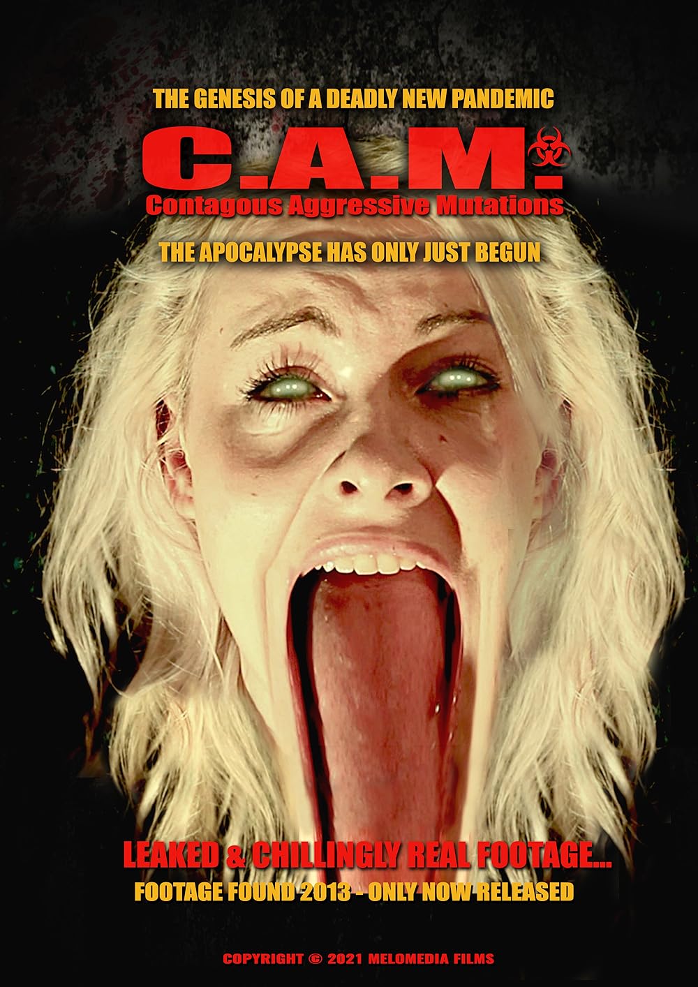 C.A.M.