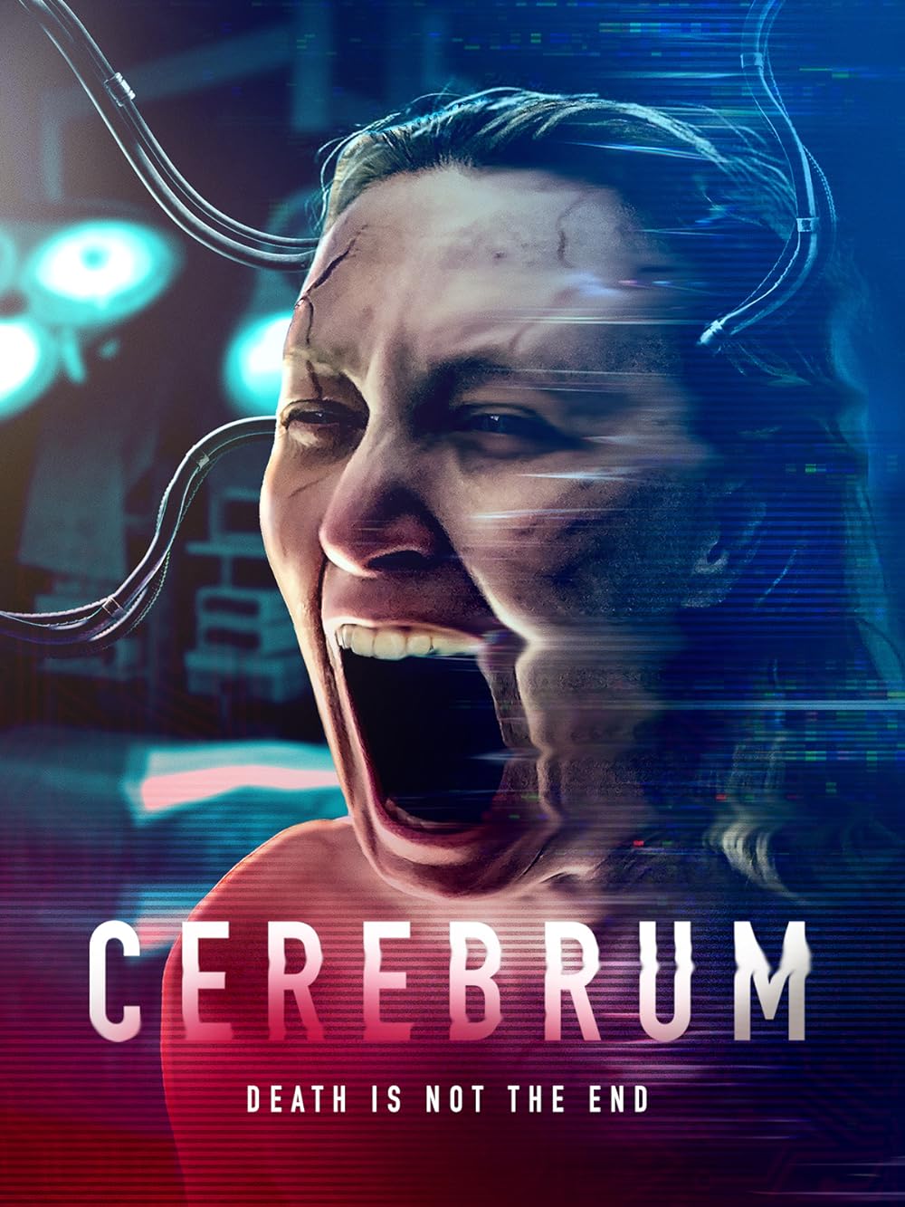 Cerebrum Cerebrum