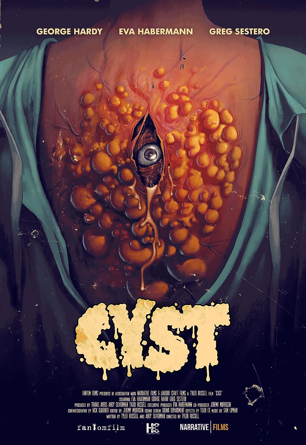 Cyst Cyst