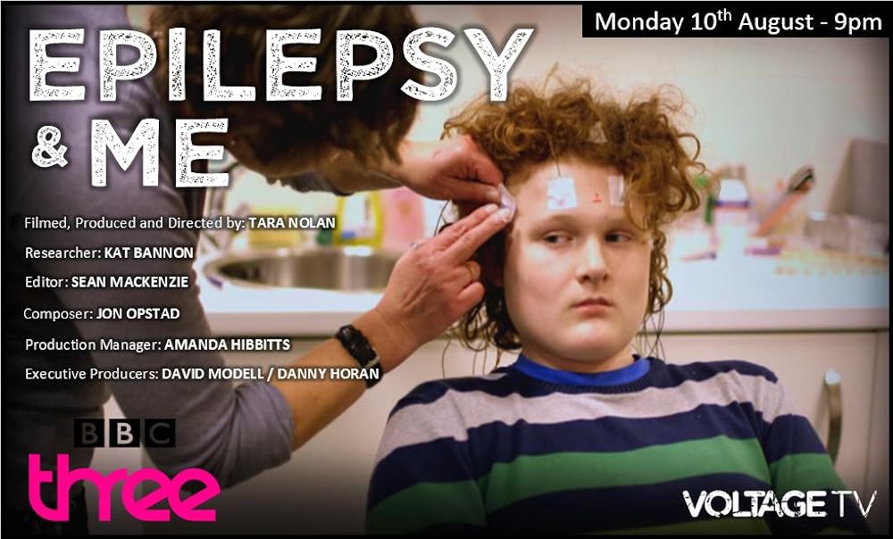 Epilepsy Epilepsy