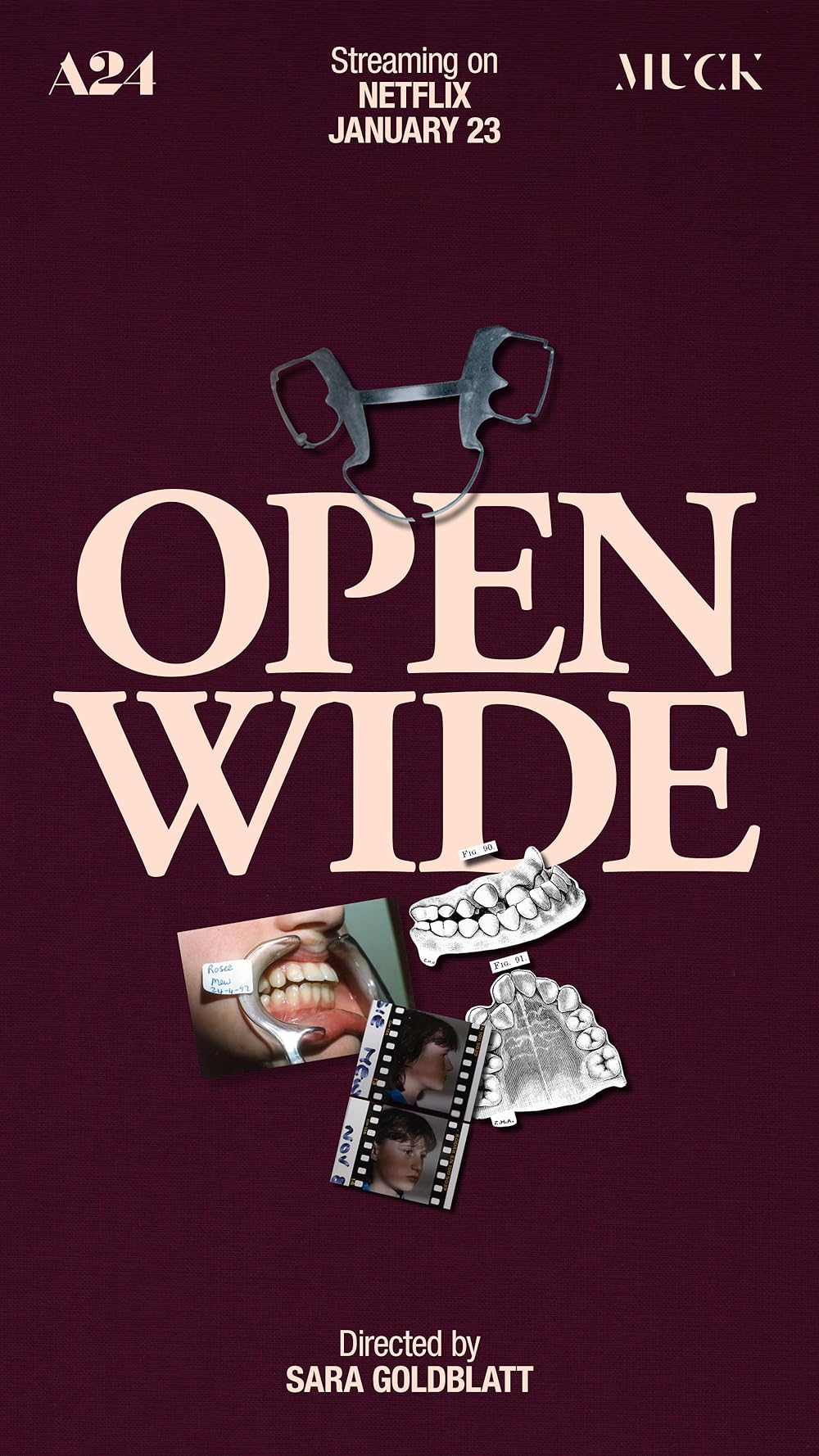 Open Open