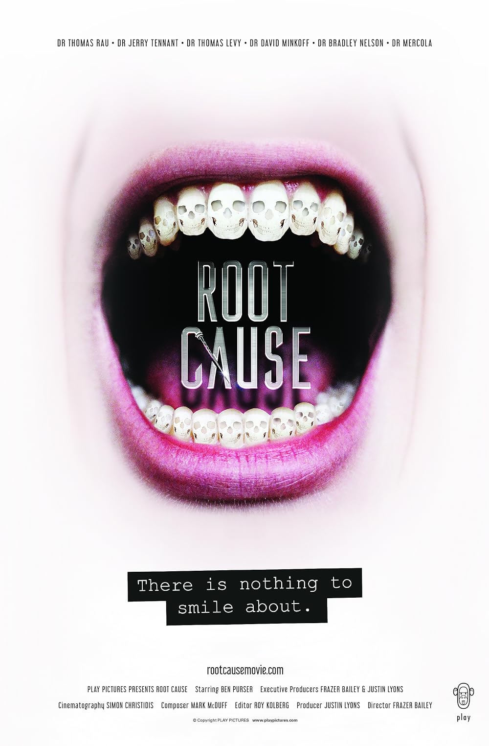Root Root
