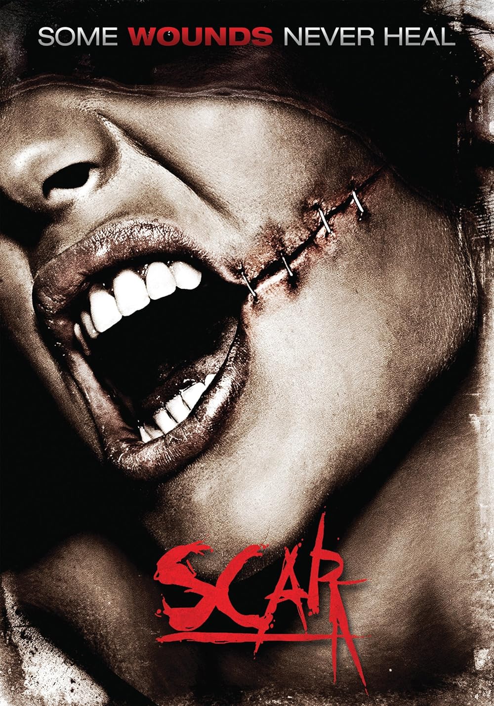 Scar Scar