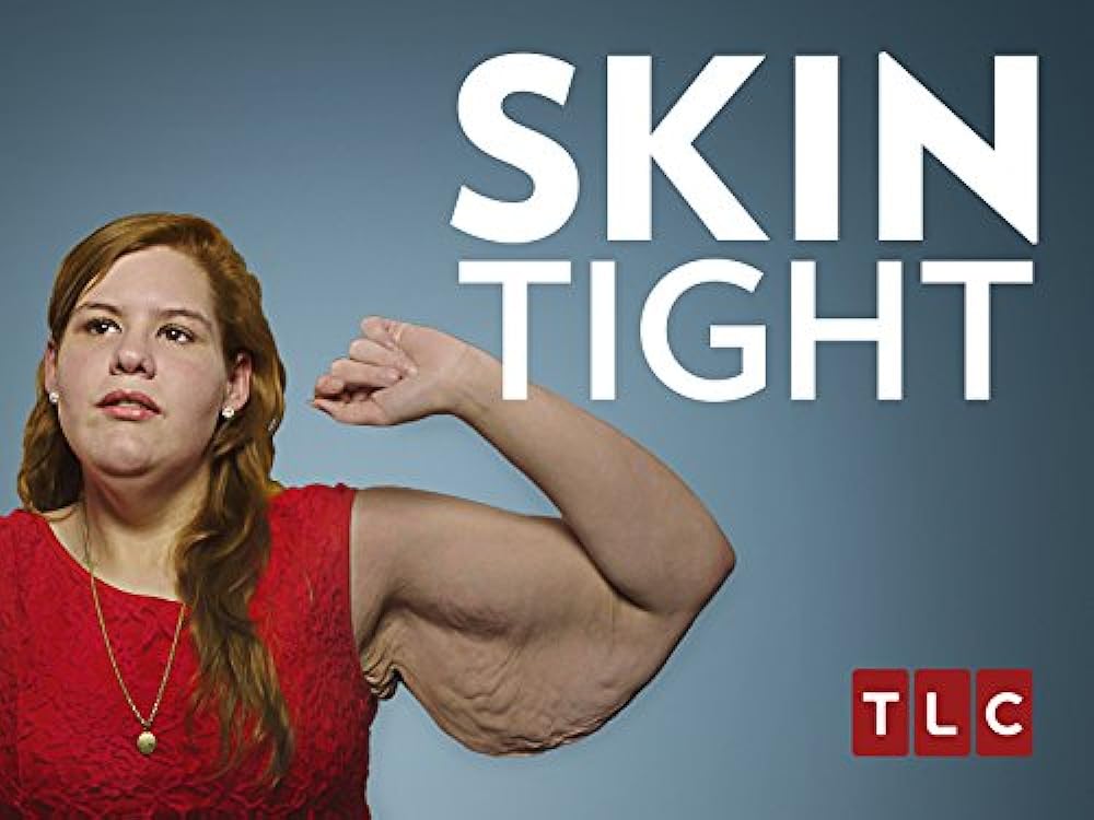 Skin Skin