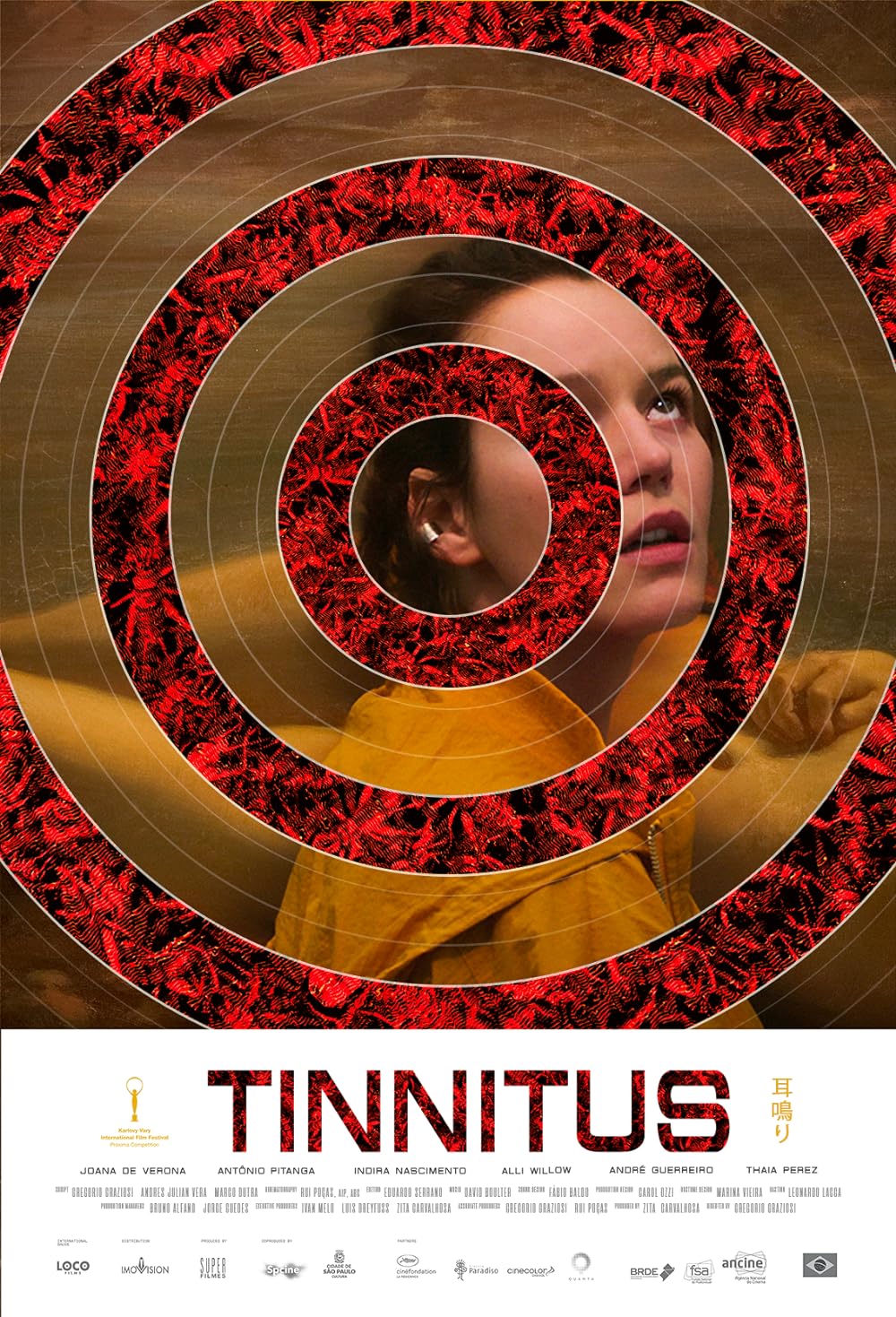 Tinnitus Tinnitus