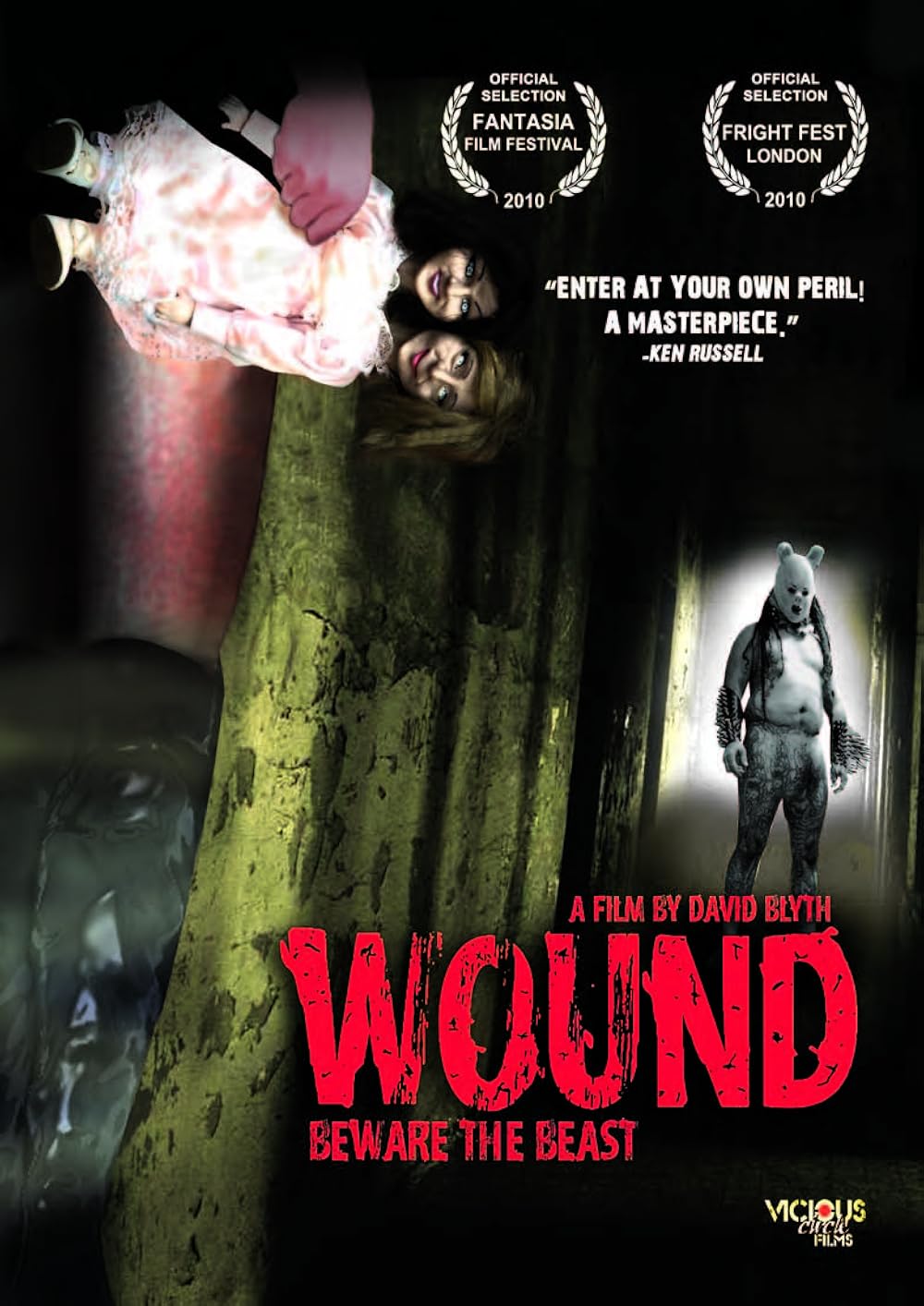 Wound Wound